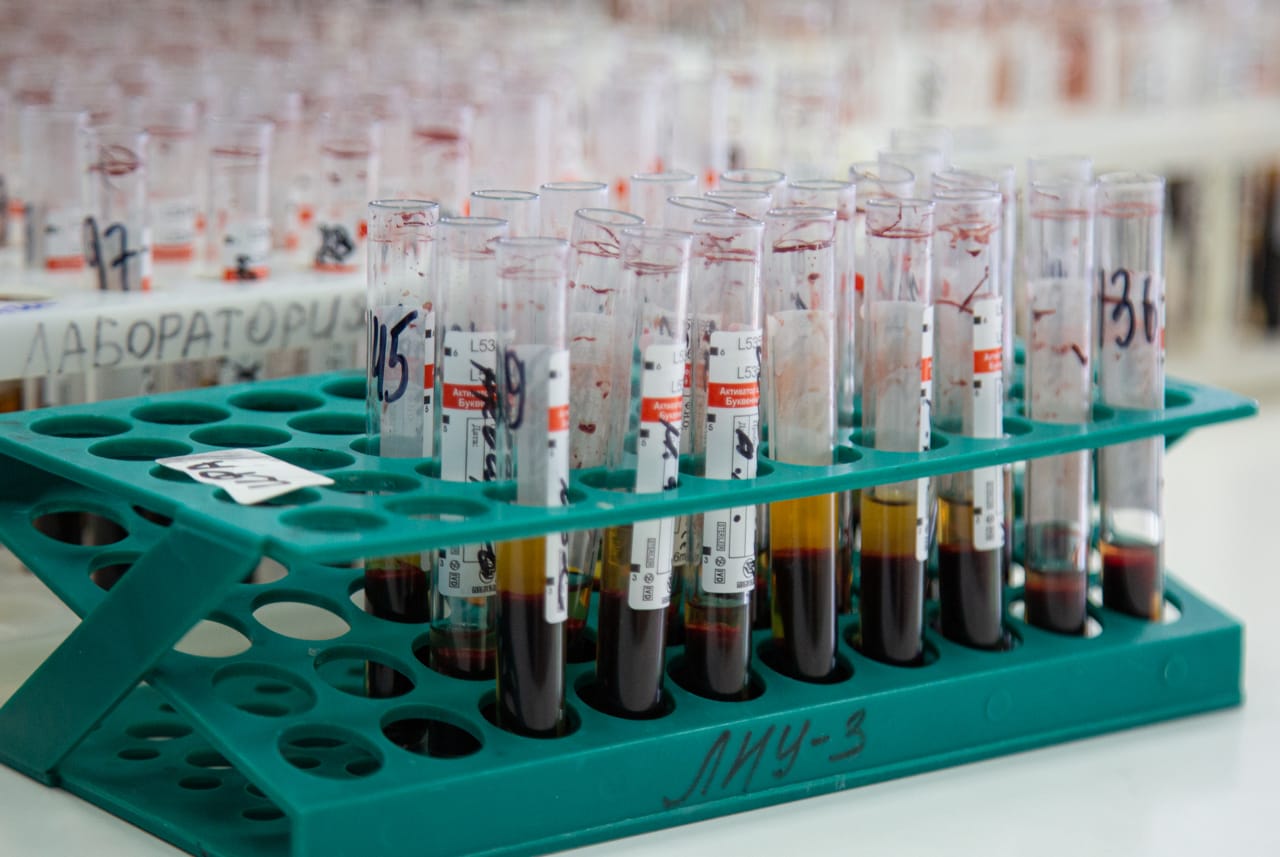 За ушедшие сутки 9 жителям Тульской области поставили диагноз «коронавирус»