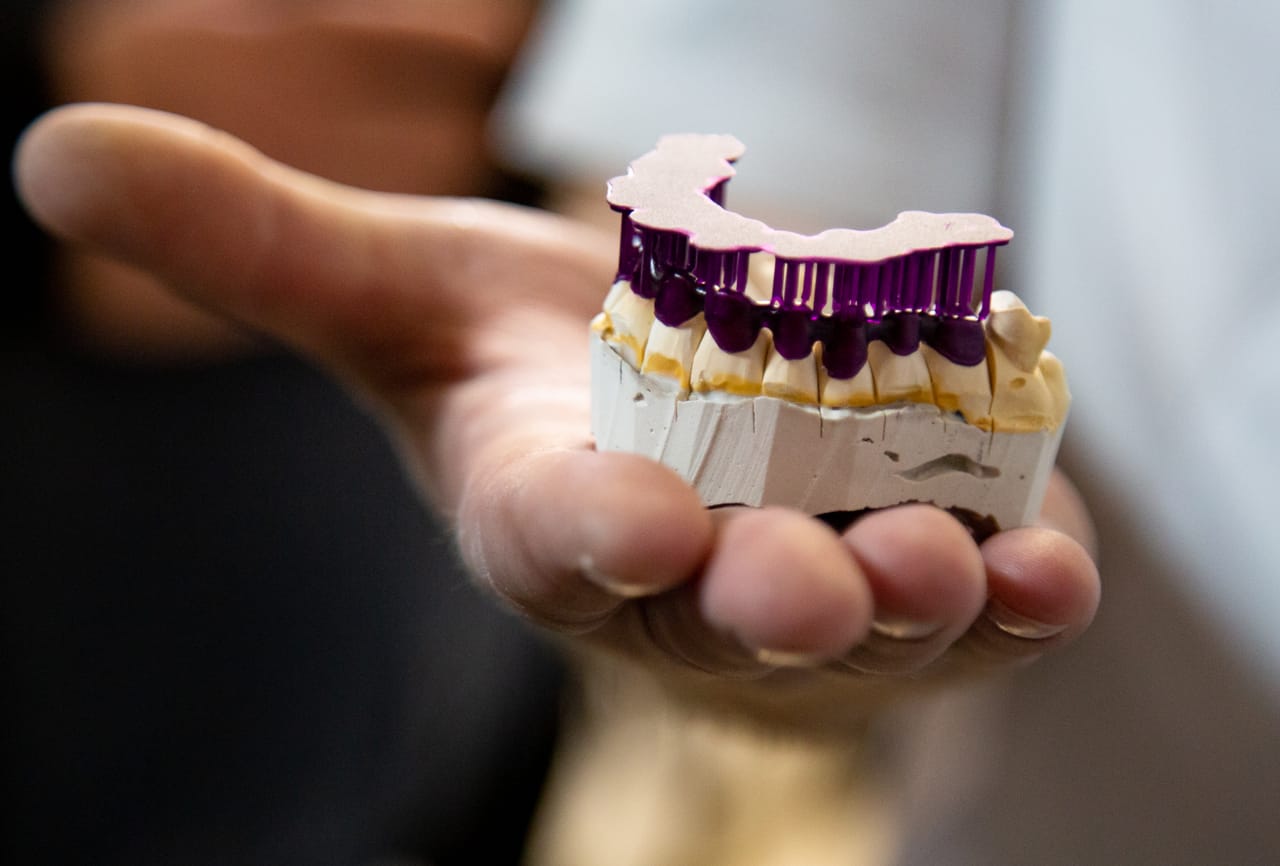 Кому в Тульской области положено льготное протезирование зубов