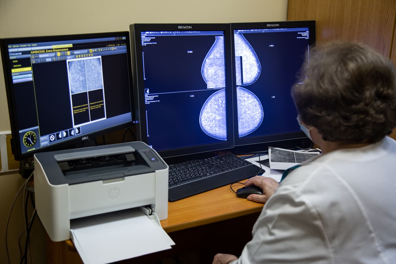 Тула подключилась к "МосМедИИ" для анализа рентген-исследований с помощью ИИ