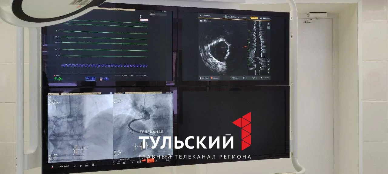 Тульские врачи смогут раньше выявлять у пациентов сердечно-сосудистые заболевания