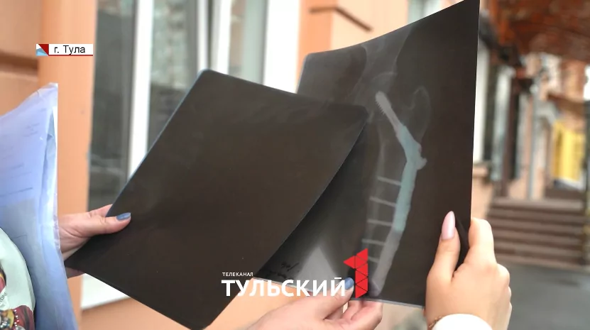 Тулячка два года судится с магазином из-за травмы на ступенях