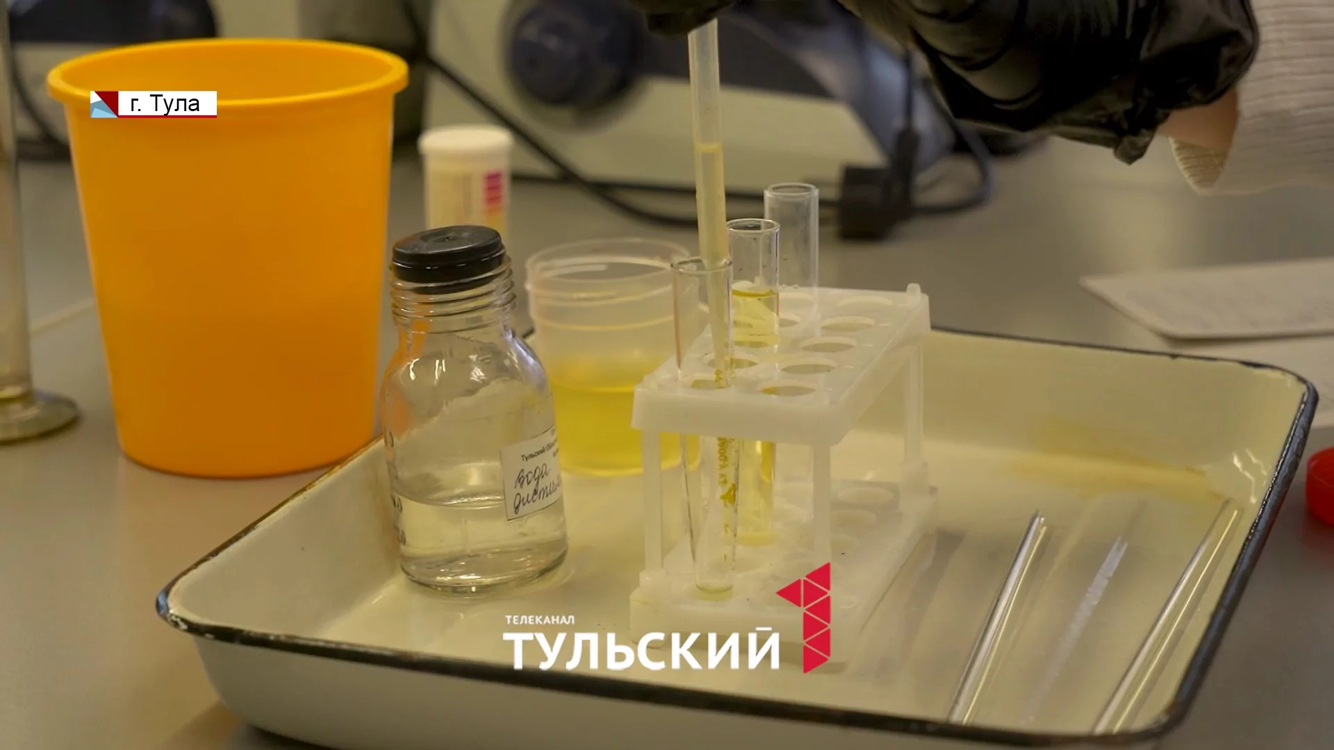 Что нельзя делать перед сдачей анализов: советы от лаборанта