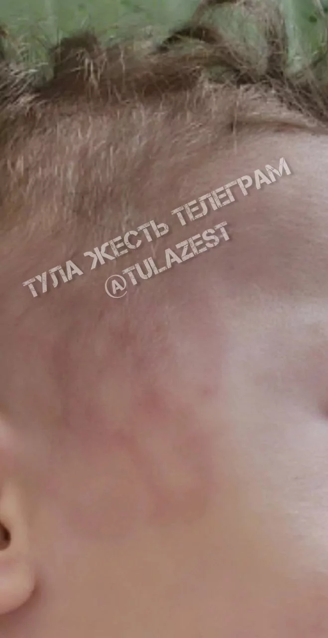 Следственный комитет проверит информацию об избиении ребенка в тульском детском саду