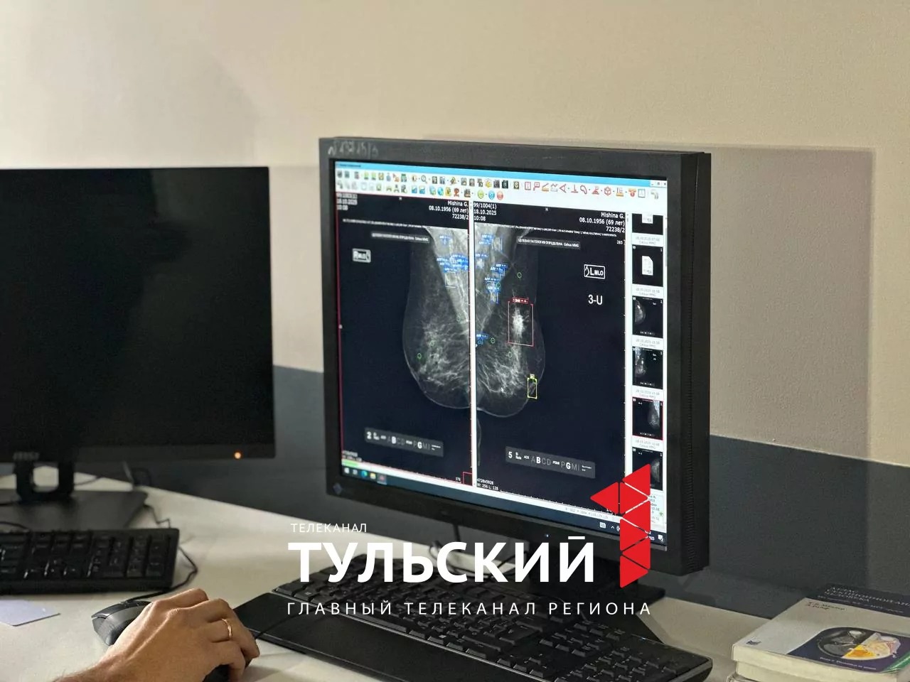 Тульский онколог рассказал, что может спровоцировать рак груди
