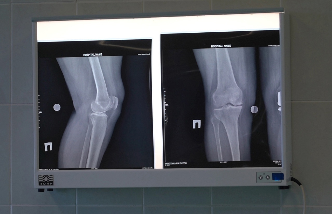 Тульские врачи назвали причины хруста в коленях