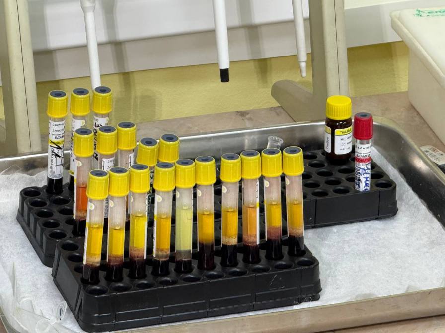 В Туле врачи смогут проверять на ВИЧ в два раза больше пациентов