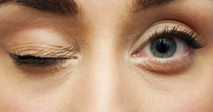 Дергающийся глаз» может оказаться признаком серьезного заболевания ...