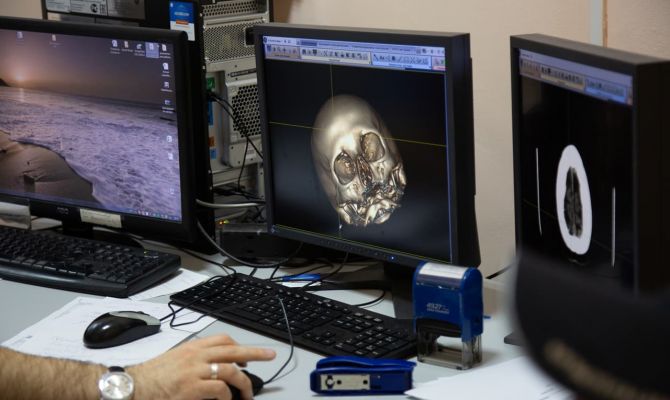 Тульский психолог назвал топ-5 неочевидных признаков депрессии у ребёнка