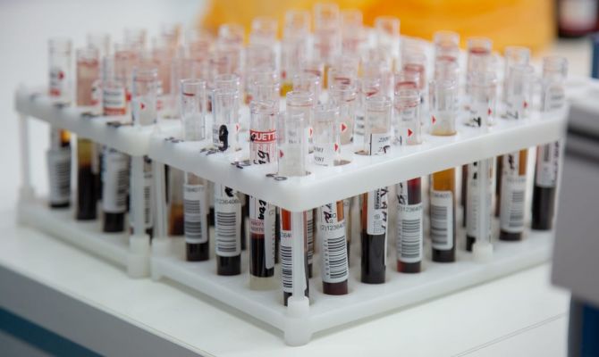 Стало известно, сколько туляков страдают сахарным диабетом