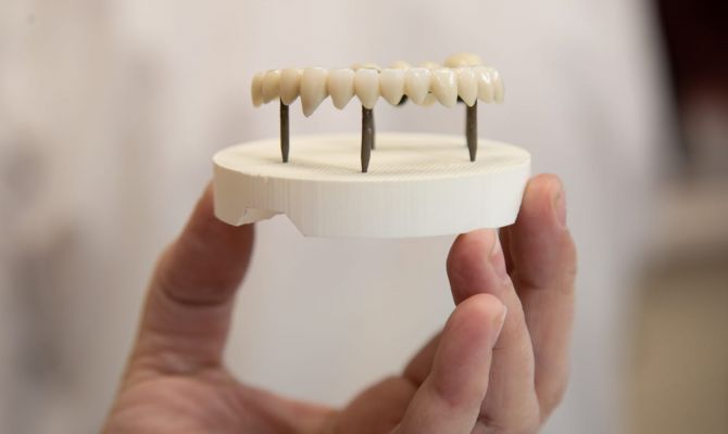 Тулякам рассказали, кто имеет право на бесплатное протезирование зубов