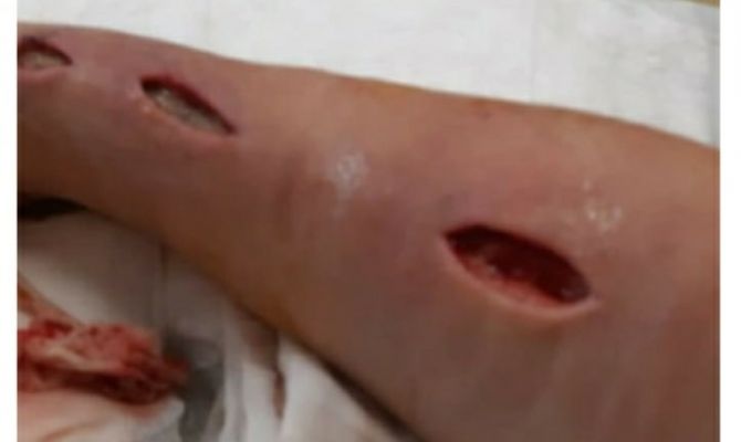 Жительница Киреевска пожаловалась на Центральную районную больницу