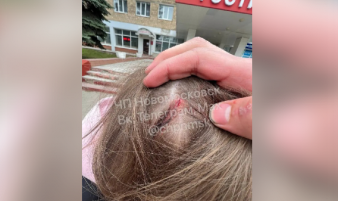 В Новомосковске подростка избили в автобусе: возбуждено уголовное дело
