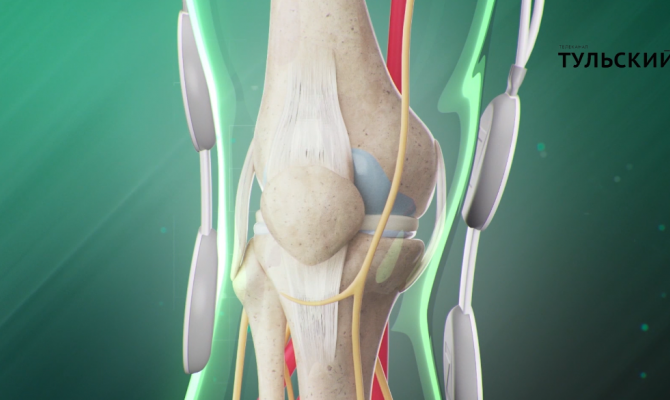 Как тулякам вылечить заболевания суставов и позвоночника