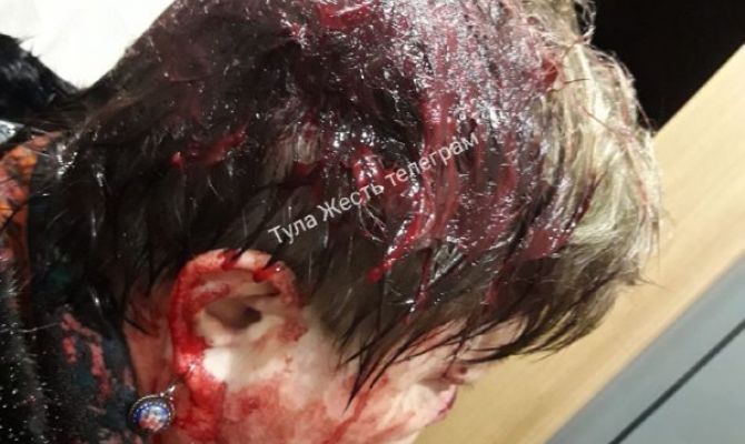 В Туле по факту нападения на женщину-врача возбуждено уголовное дело