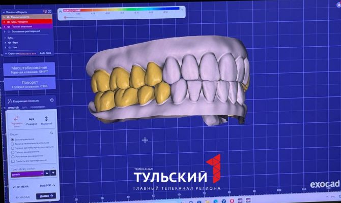 Стоматолог объяснила, почему появляется зубной камень
