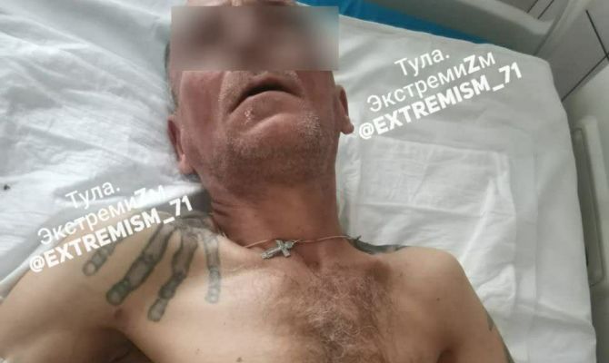 Попавшего под машину ефремовца арестовали за демонстрацию в больнице нацистской татуировки