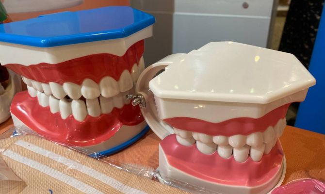 Стоматолог объяснила, правильно ли раскачивать молочные зубы