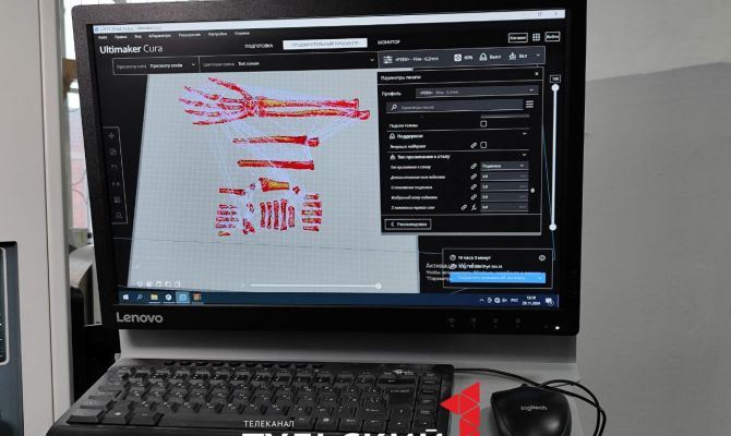 Тульские студенты создают протезы конечностей на 3D-принтере