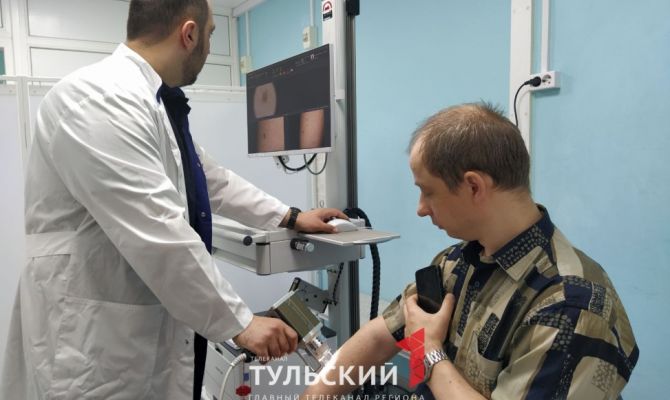 Тульские дерматологи рассказали, как отличить меланому от родинки