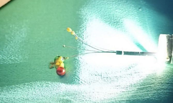 Врачи спасли мальчика из Ефремова, который проглотил магниты