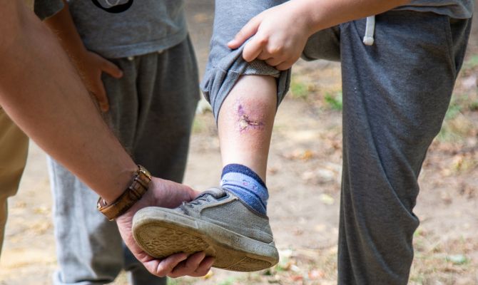 Травмы на детских площадках в Туле стали причиной проверки прокуратуры