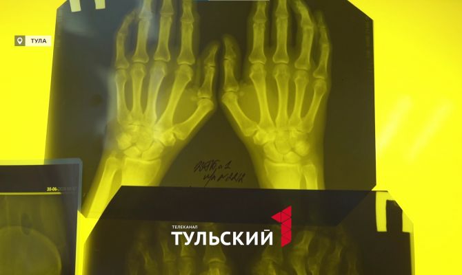 Что нужно знать о боли в суставах: репортаж из отделения ревматологии в Туле