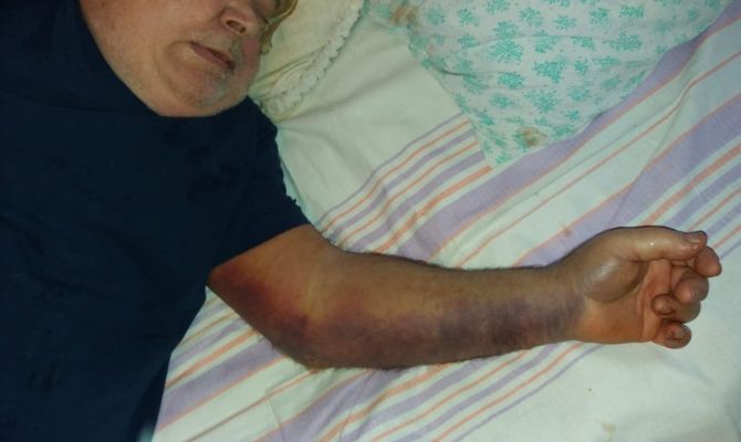 Жительница Новомосковска пожаловалась на отношение медиков к своему отцу – пациенту НГКБ