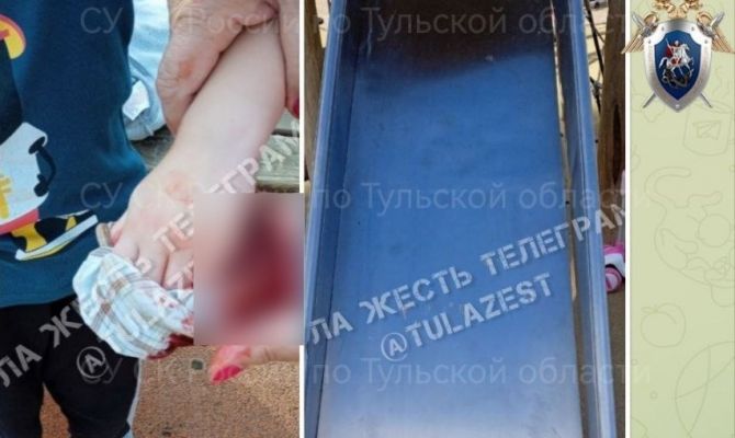 В Туле ребенок изрезал руку на детской площадке на улице Кауля