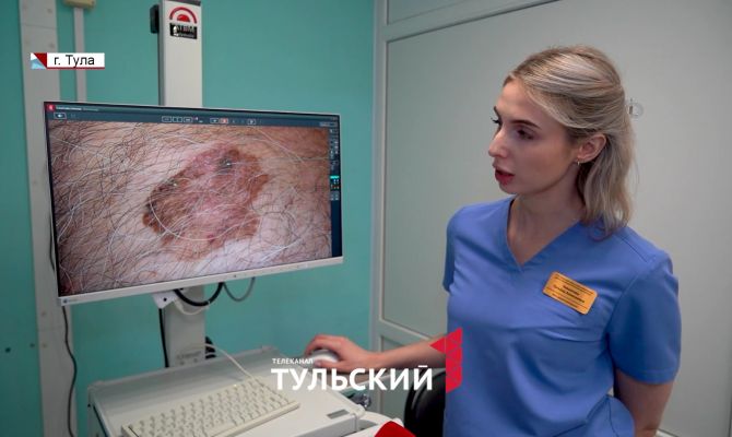 Онкологи сравнили внешний вид простой и раковой родинки