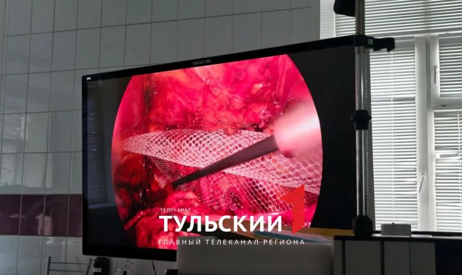 Тульские хирурги удаляют паховые грыжи через небольшие проколы
