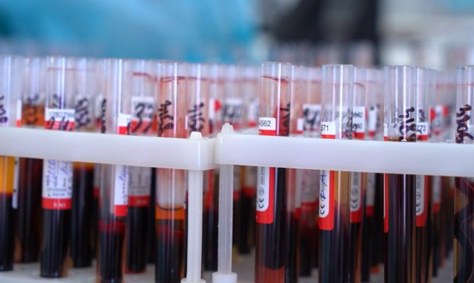 Названы самые частые факторы передачи гепатита С в Туле