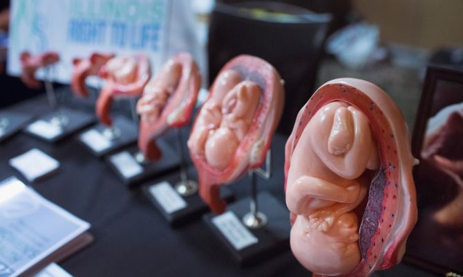 Станут ли аборты в России платными 