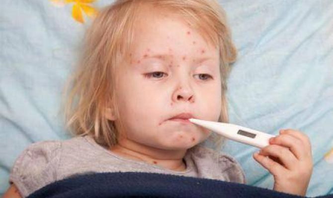 Россиян предупреждают о вспышке кори в странах Европы