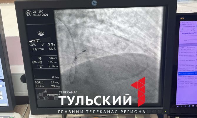 Тульские врачи впервые провели операцию на сердце через лучевые артерии