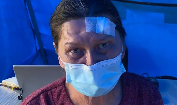 Тульские врачи спасли жизнь женщине из Мариуполя с металлической пластиной в голове