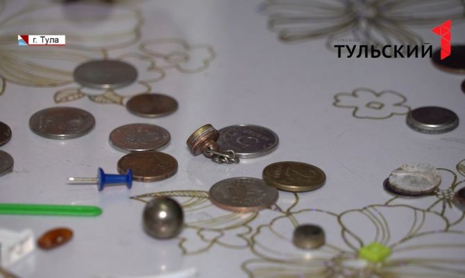 Монеты, булавки, батарейки: что чаще всего находят врачи в желудке маленьких туляков
