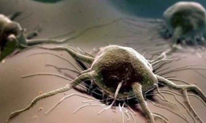 Ученые рассказали, какая пища увеличивает раковую опухоль