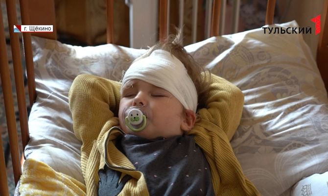 В г. Щекино упавший с 5-этажки камень раскроил голову ребенку: делом занимаются правоохранители