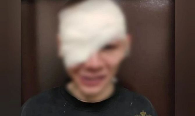 В Кимовске мужчина ударил посетителя кафе стеклянным бокалом