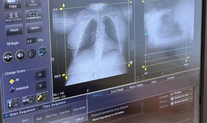 У 7 жителей Тульской области за сутки выявили подозрение на рак