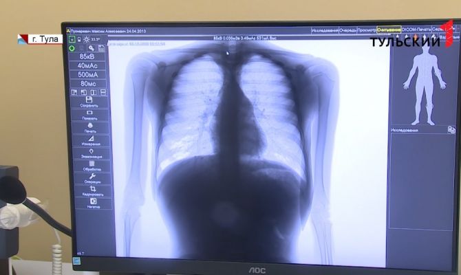 Врач объяснила, почему туберкулез перестал быть болезнью маргиналов