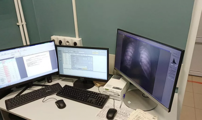 Тульские поликлиники пополнились новыми флюорографами