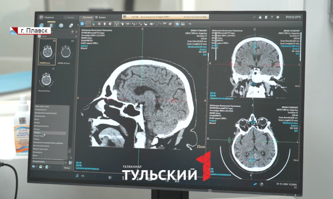 В больнице Плавска научились ставить диагнозы за 10 минут