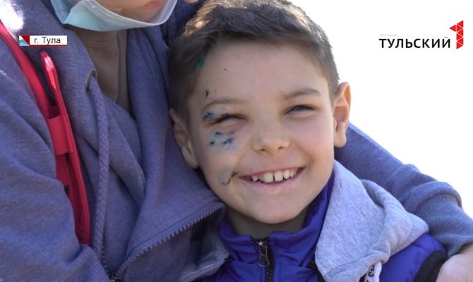 Три шва на лице: мальчик рассказал о нападении собаки на детской площадке