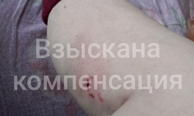 В Туле инвалид получит компенсацию за укус бездомной собаки