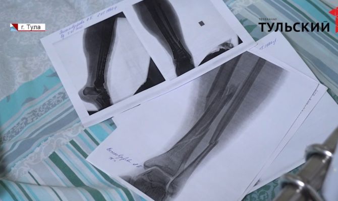 Суд по иску жительницы Ясногорска к районной больнице пройдет 27 сентября