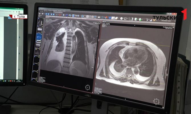 Как тулякам обнаружить поражение легких при коронавирусе