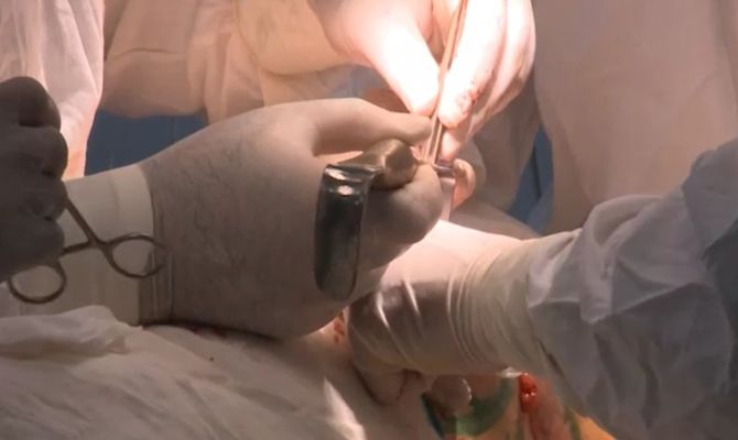 В России пересадили напечатанную на принтере печень