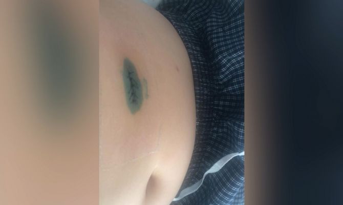 Под Новомосковском ребенка и собаку ранили из ружья: что произошло на самом деле